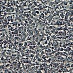 Melatonina: la hormona del sueño y el ritmo circadiano