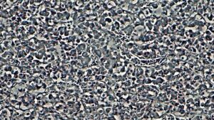 Melatonina: la hormona del sueño y el ritmo circadiano