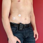 Diabetes tipo 1: destrucción autoinmune de las células beta