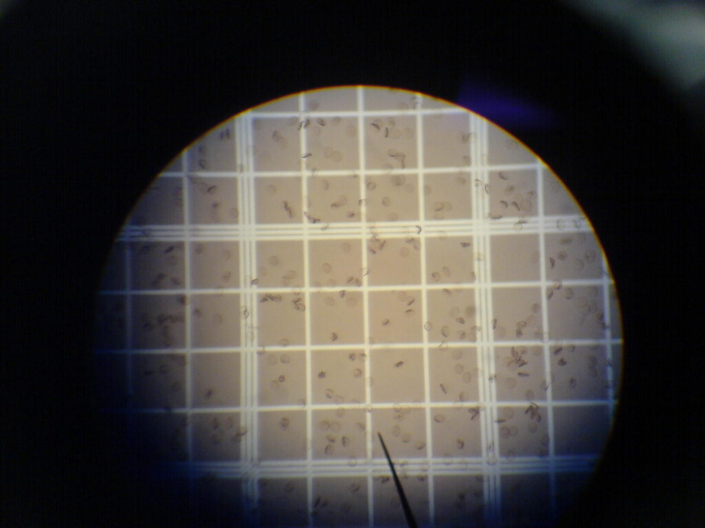 Glóbulos rojos (eritrocitos)