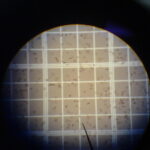 Glóbulos rojos (eritrocitos): estructura, función y enfermedades