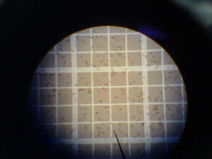 Glóbulos rojos (eritrocitos): estructura, función y enfermedades