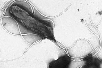 Helicobacter pylori: la bacteria que coloniza el estómago