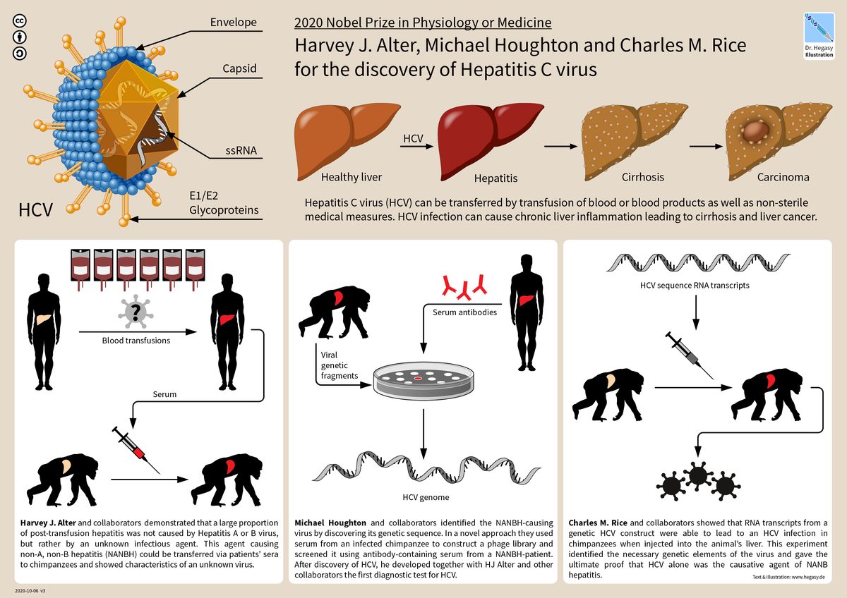 Diagrama del hígado inflamado por hepatitis