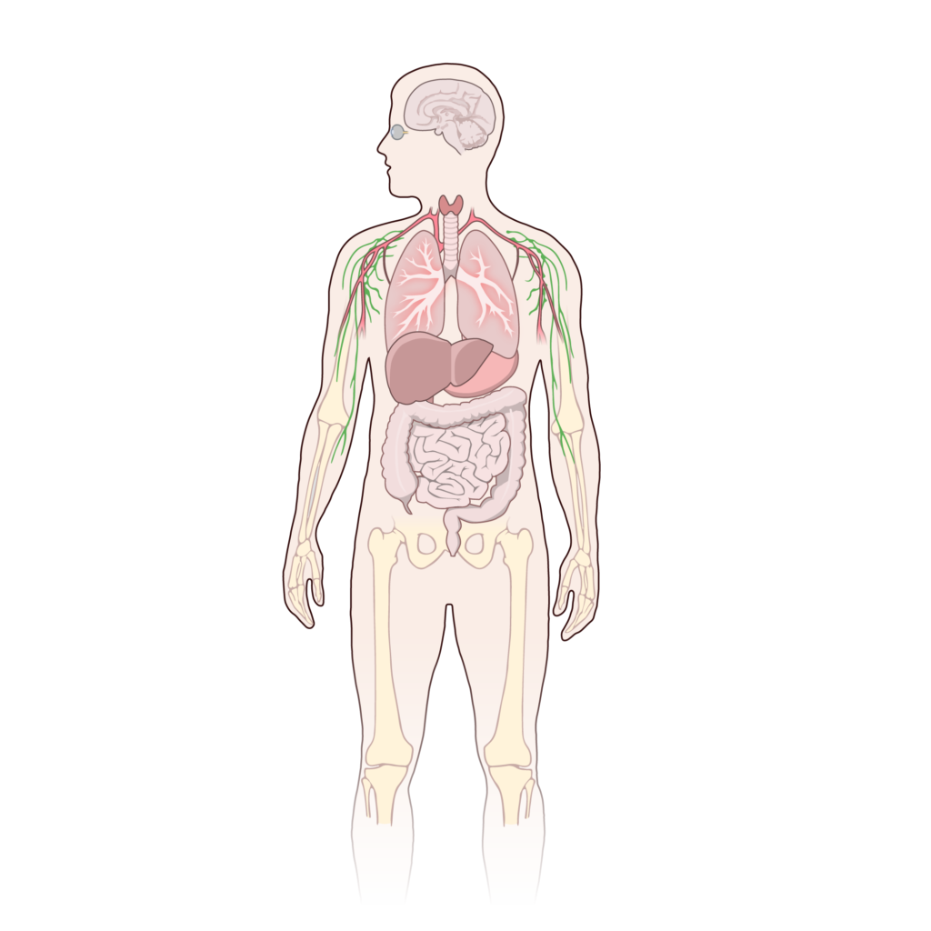 Hepatocarcinoma: cáncer hepático primario, diagnóstico y tratamiento