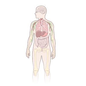 Hepatocarcinoma: cáncer hepático primario, diagnóstico y tratamiento
