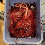 Placenta