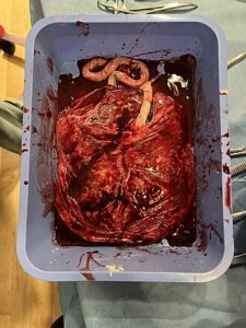 Placenta