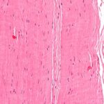 Tendones y ligamentos